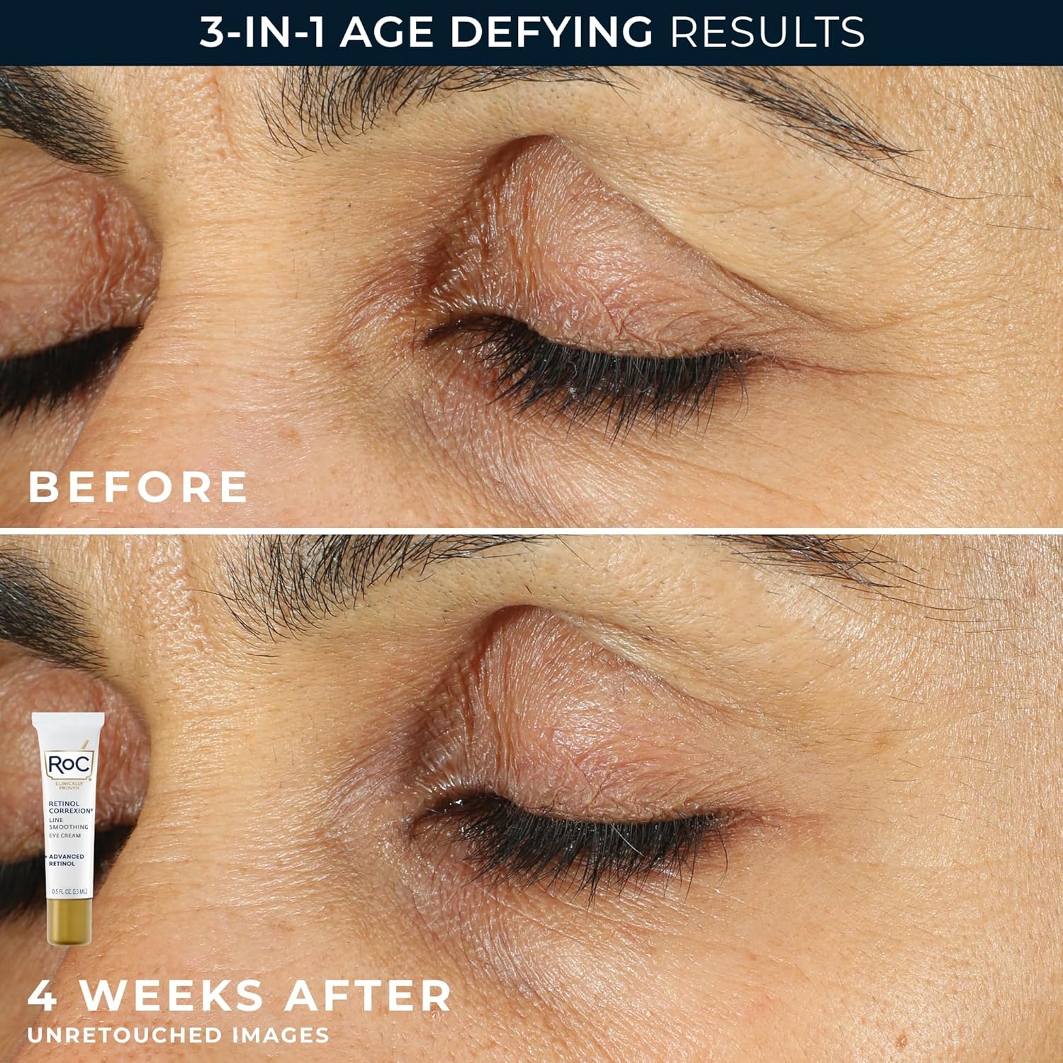 RoC Retinol Correxion Value Set Duo, Deep Wrinkle Anti-Aging Night Face Cream + Under Eye Cream for Dark Circles & Puffiness - Retinol Eye Care